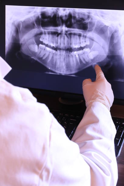Best Emergency Wisdom Tooth Extraction in Browntown, PA